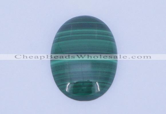 CGC02 20PCS 4*6mm oval natural malachite gemstone cabochons